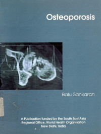 Osteoporosis