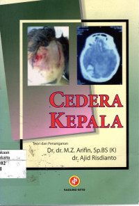 Cedera Kepala