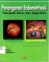 Penanganan Endometriosis: panduan klinis dan algoritme