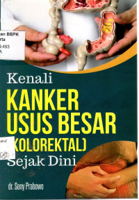 Kenali Kanker Usus Besar (Kolorektal) Sejak Dini