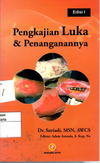 Pengkajian Luka & Penanganannya