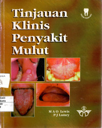 Tinjauan Klinis Penyakit Mulut